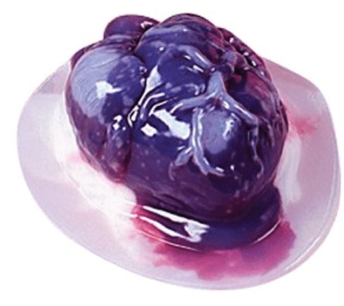heart-gelatin-mold